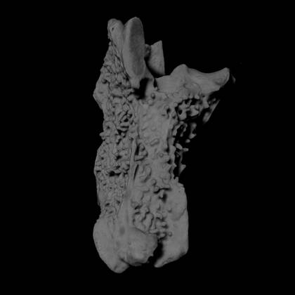 Volume rendering of the cervical vertebra